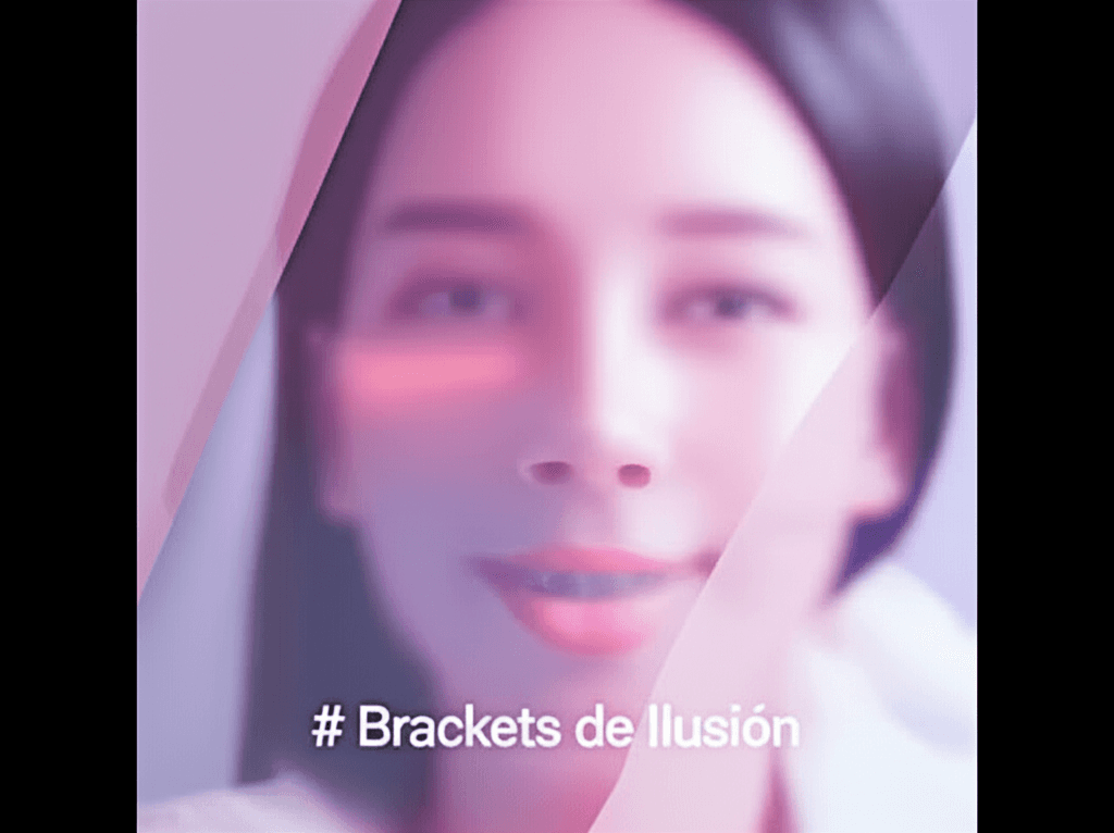 Brackets de Ilusión 1